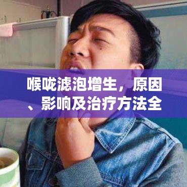张弓拔弩 第2页